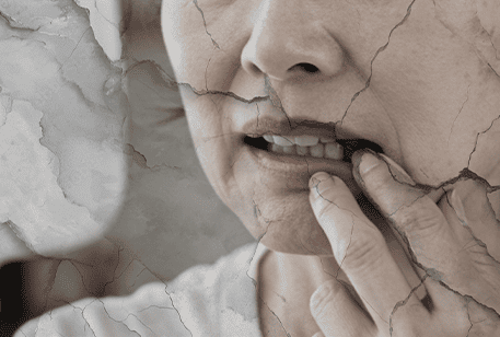 歯の健康へのリスク