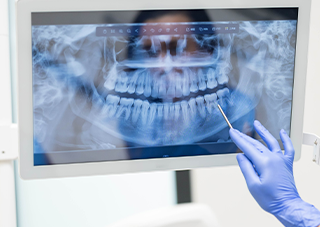 丁寧な検査とカウンセリング