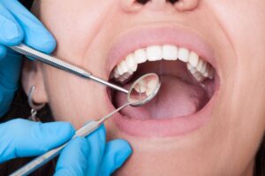 歯の治療を受ける女性と、治療器具を使って治療をする歯科医師