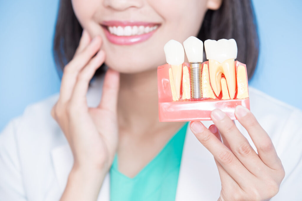 インプラントの模型を持って笑う女性歯科医師