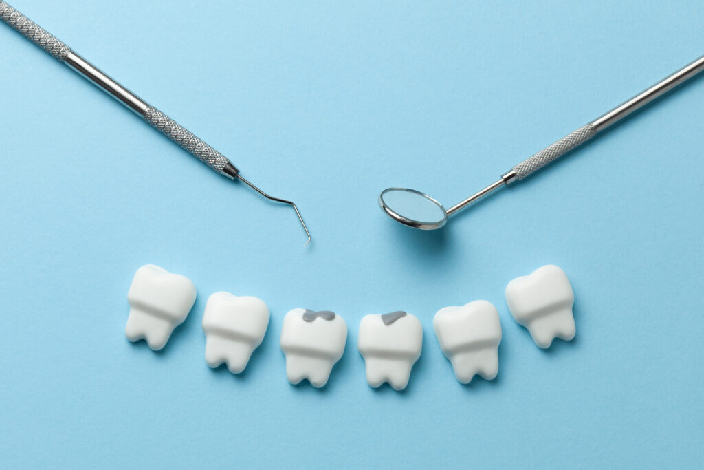 青い机に置かれた歯と虫歯と歯科用器具
